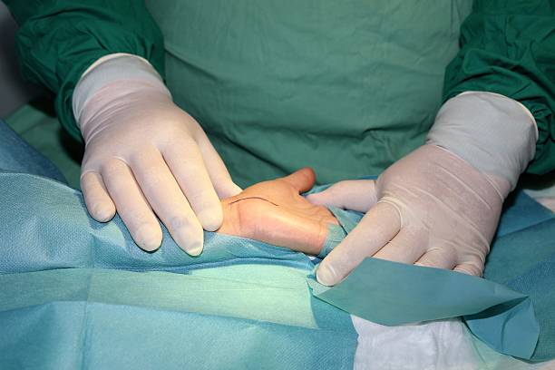 Surgeon operates carpal tunnel syndrome